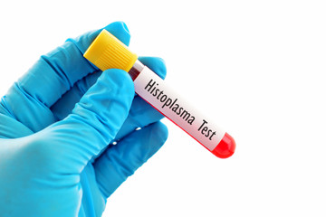 Obraz premium Blood for Histoplasma test