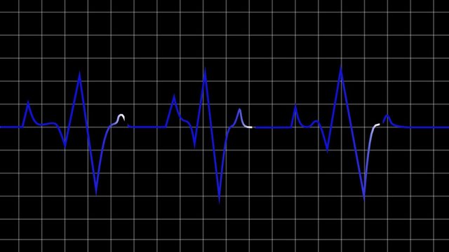 00:01 | 00:20
1&times;

Animated loop able heart beat graphic depicted on black graph background useful for science medicine and technology based program