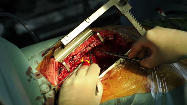 The surgeon makes an operation on the heart