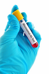 Fototapeta premium Blood for microsomal antibody test