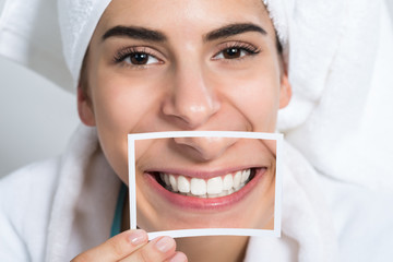 Woman Holding Photo Of Toothy Smile