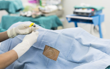 epidural nerve block