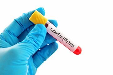 Blood sample for chloride (Cl) test