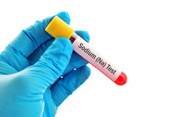 Obraz premium Blood sample for sodium (Na) test