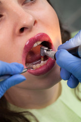  Young girl having dental check up