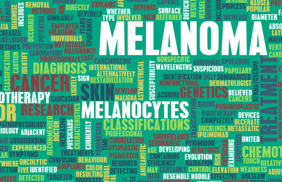 Melanoma