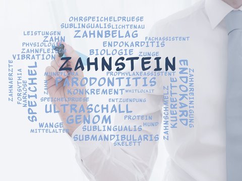 Zahnstein