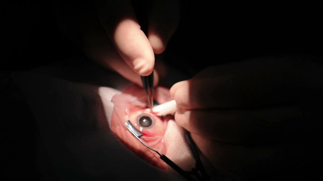 Hands doctor with tools making eye surgery