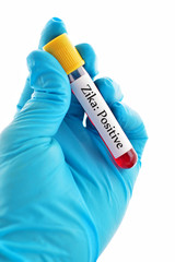 Obraz premium Blood sample positive with Zika virus 