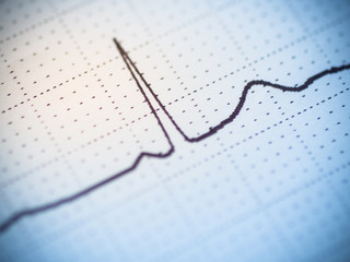 Close up of an electrocardiogram.