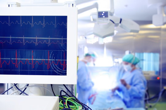 Monitoring of cardiac function during surgery