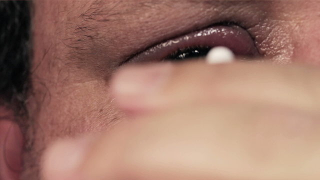 Man treating infected eye