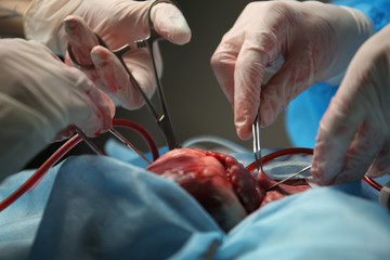 Doctor doing heart operation - obrazy, fototapety, plakaty