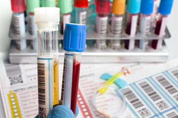 hand holding samples of Blood and urine in tube over medical report / man holding tubes with...