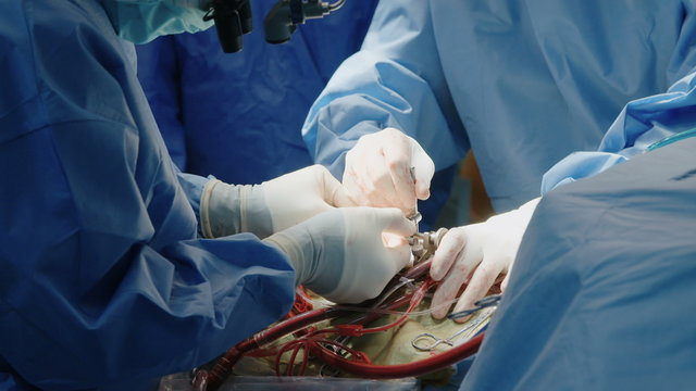 Surgeons during open heart surgery