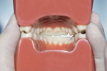 interior view of dental model © mkarco
