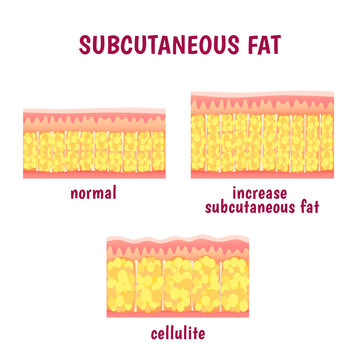 leather sectional layer of subcutaneous fat