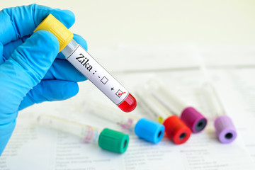 Obraz premium Blood sample positive with Zika virus