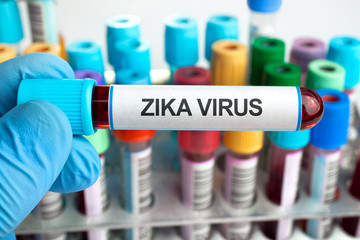 Blood tests with text zika virus / hand holding a tube labeled with the words pika virus and in the background a rack with other tests