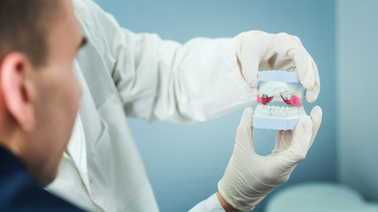 Dentist showing dental gypsum model to patient. Human teeth jaw.