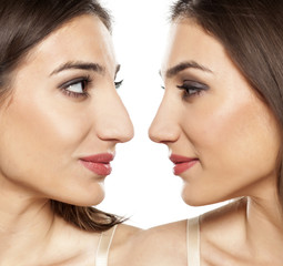 comparative portrait of a beautiful young woman, before and after rhinoplasty