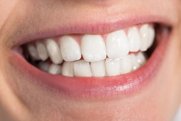 Woman Showing Healthy White Teeth