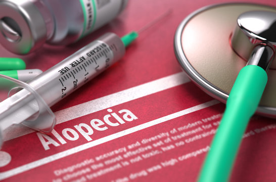 Alopecia. Medical Concept on Red Background.