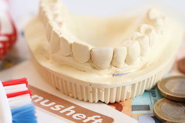 Gipsabdruck und Zahnbürste