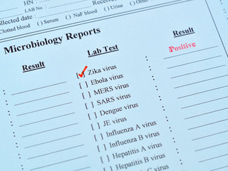 Fototapeta premium Zika virus positive result 