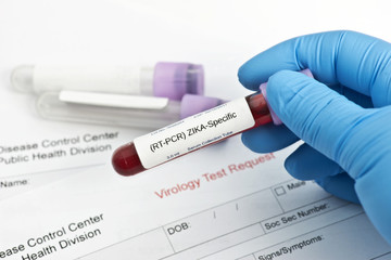 Obraz premium Zika Virus Lab Test