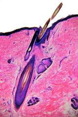 Human skin with hair - microscopic image