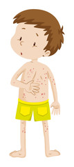 Little boy with rashes in his back