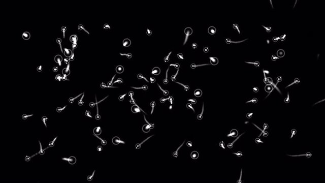detecting moving microbes or bacteria under microscope 4K