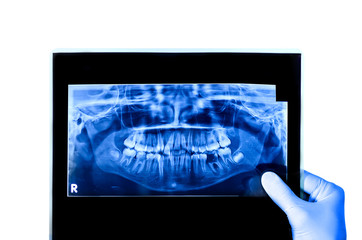 Dentist holding & viewing full mouth X-ray of a patient isolated in white background