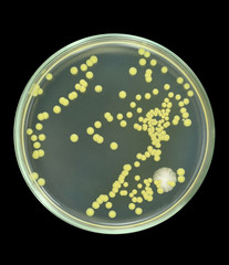 Colonies of bacteria from sea water on a petri dish (agar plate) isolated on black background. Nutrient agar media (meat-peptone agar) used.  Focus on full depth.