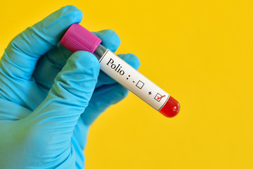 Obraz premium Polio virus positive