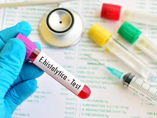 Blood sample for Entamoeba histolytica (E.histolytica) test
