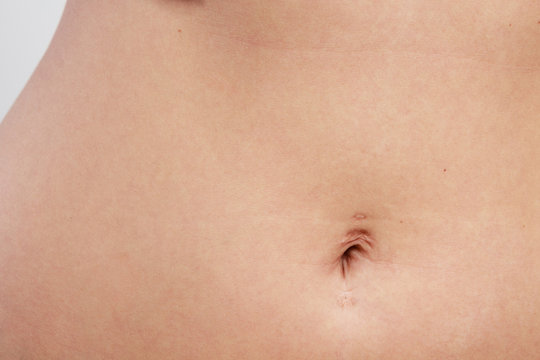 woman belly with piercing scar in the navel