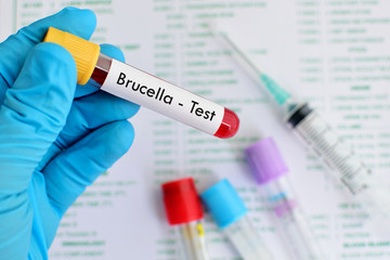 Obraz premium Blood sample for Brucella bacteria infected test 