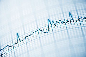 Electrocardiogram