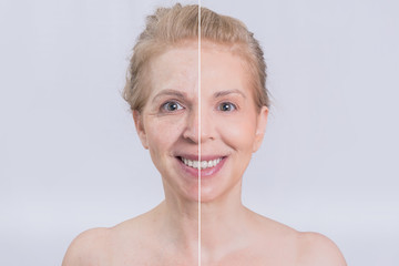 Before and after skin treatment transformation 