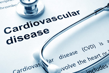 Paper with words Cardiovascular diseases and stethoscope.