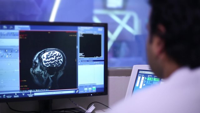 MRI research. Brain imaging. Pictures of the brain scan on the monitor.