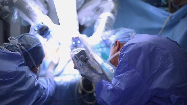 Robotic Surgery. Medical robot.  Medical operation involving robot - Stock Video