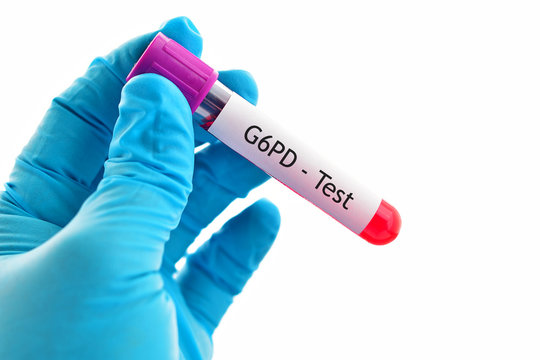 Blood sample for G6PD (Glucose-6-phosphate dehydrogenase) test


