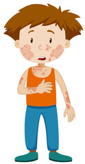 Boy with infectious disease