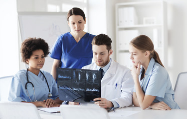 Fototapeta premium group of doctors discussing x-ray image