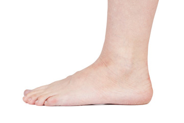 Foot of man with dry skin on a white background