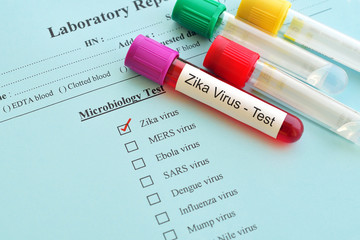 Blood sample for Zika virus test
