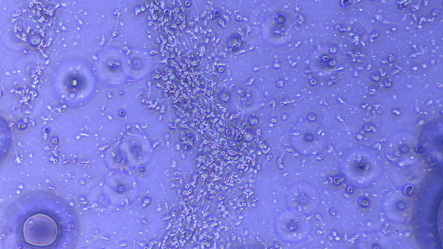 Human Sperm Seen in Phase Contrast Sample at 800x Magnification